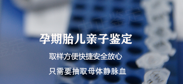 宁夏孕期亲子鉴定如何办理,宁夏正规孕期亲子鉴定中心在哪里